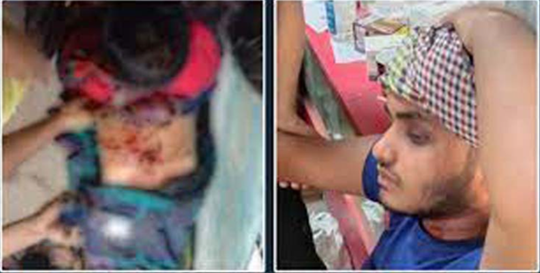 নড়াইলে নির্বাচন পরবর্তী সহিংসতায় আহত ৩০, আটক ৮